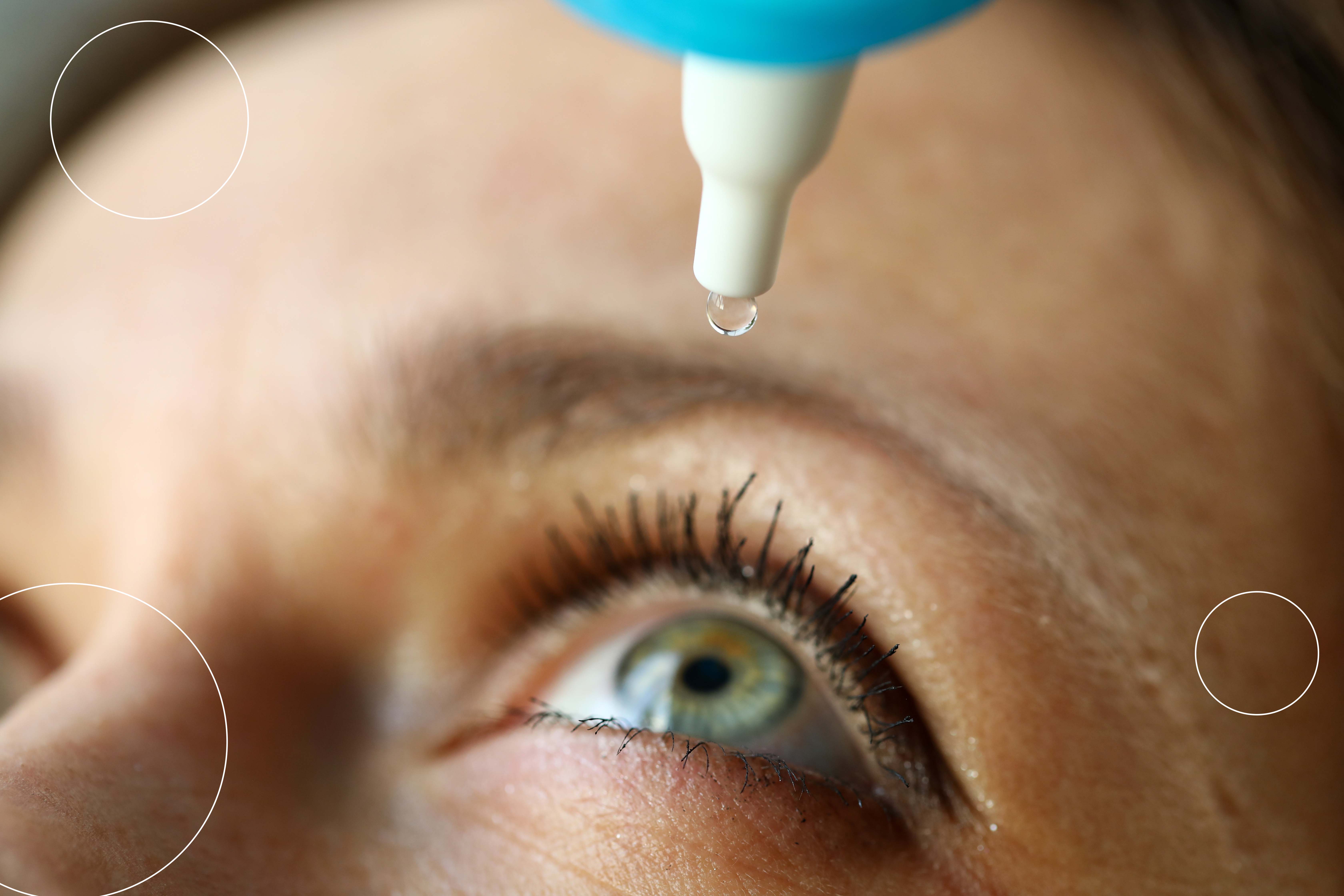 Imagen de una mujer joven que se coloca gotas de lágrimas artificiales para reducir sus síntomas de ojo seco